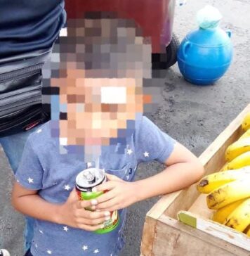 Niño de 5 años resulta lesionado tras accidente doméstico en Zacatecoluca