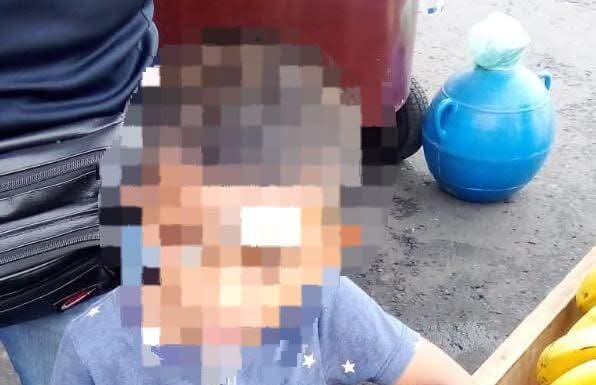 Niño de 5 años resulta lesionado tras accidente doméstico en Zacatecoluca